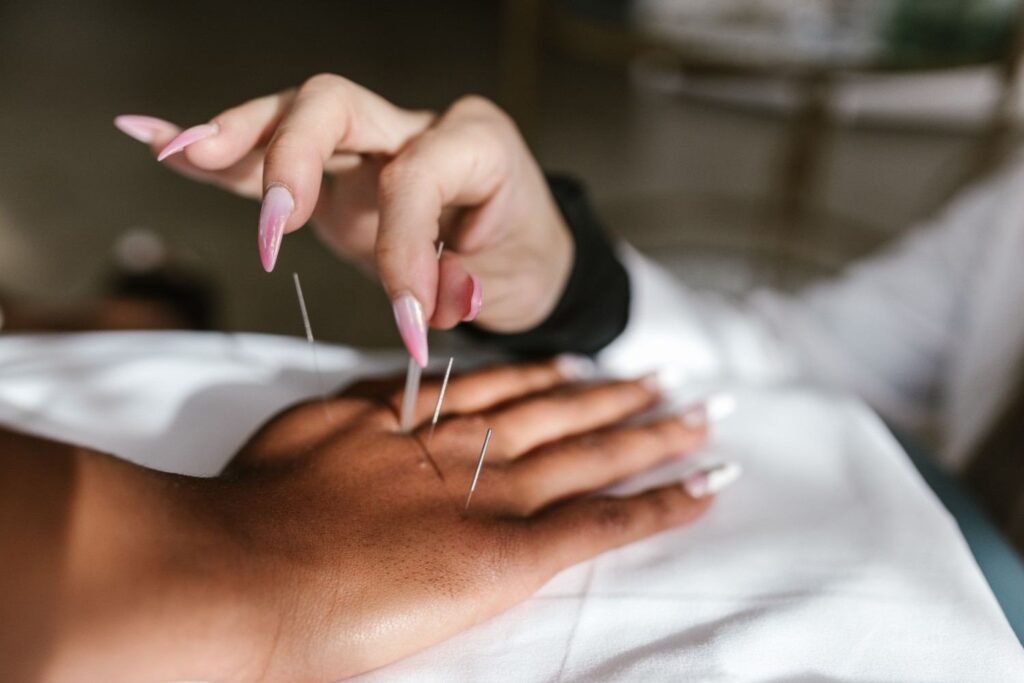 Dry Needling Langdon